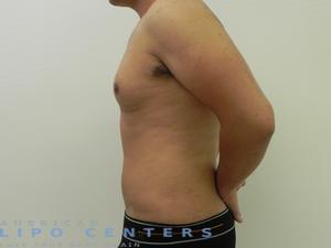 americanlipocenters_116.jpg